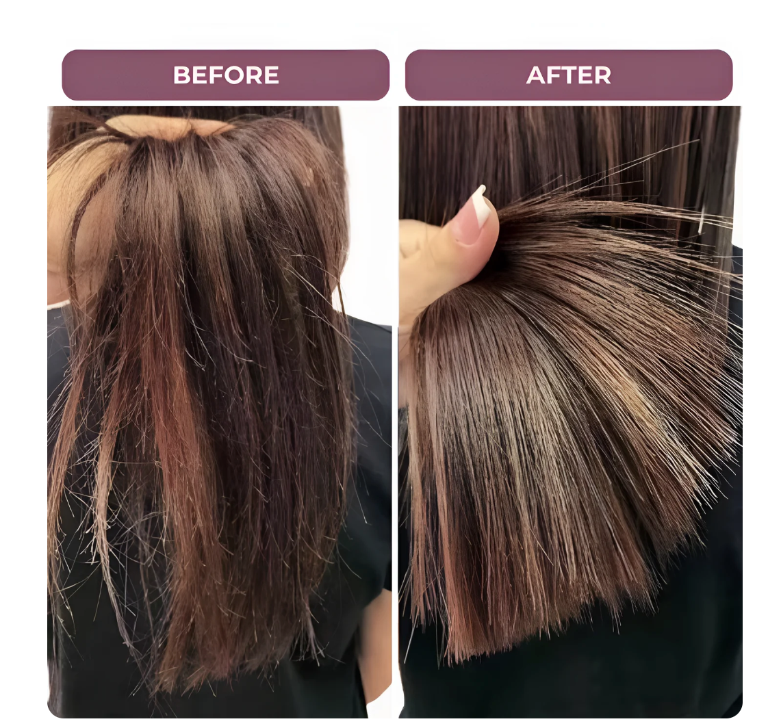 💥Owronline✨Hair Restorer